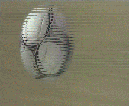 ballon